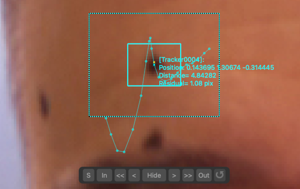 Tracker adjustment buttons